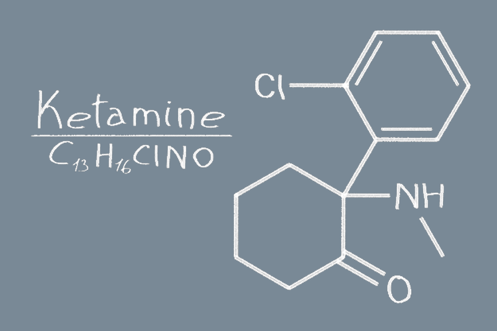 Who is Not a Good Candidate for Ketamine Therapy